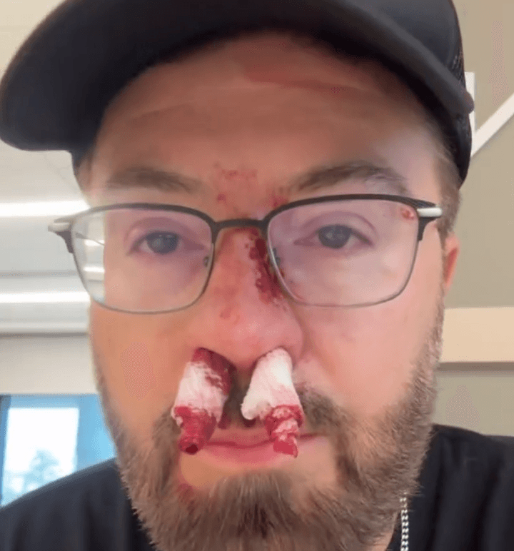 Danny Gokey sofre grave acidente doméstico e pede orações dos fãs enquanto segue em turnê